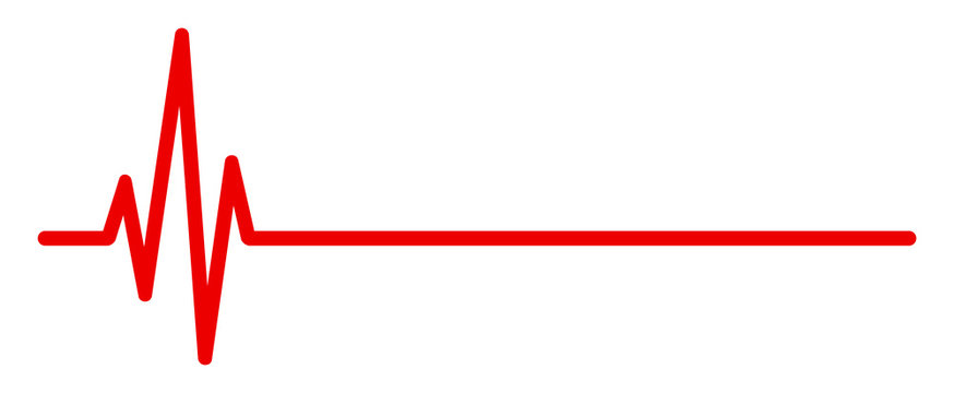 Heart rate graph overlay